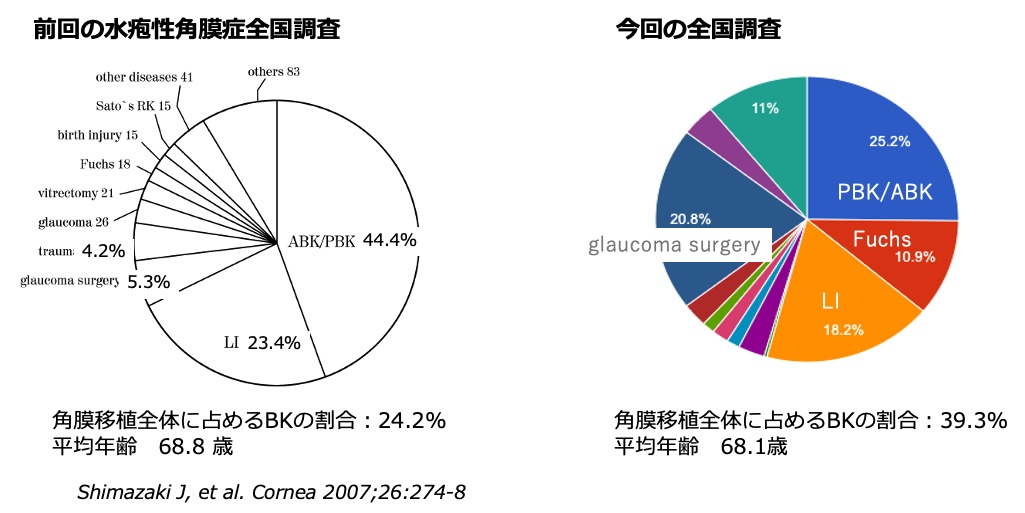 過去の報告との比較１：水疱性角膜症の原因